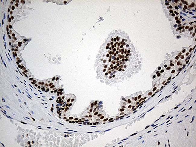 ELL Antibody in Immunohistochemistry (Paraffin) (IHC (P))