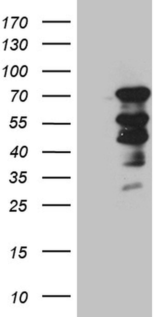 ELL Antibody in Western Blot (WB)