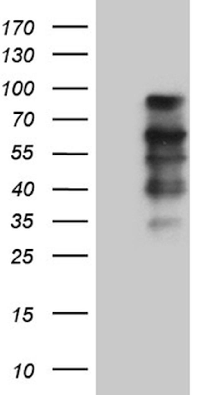 ELL Antibody in Western Blot (WB)