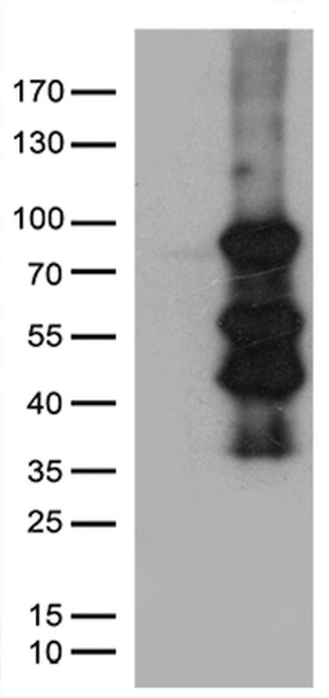 ELL Antibody in Western Blot (WB)