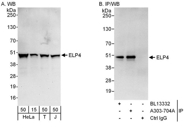 ELP4 Antibody in Western Blot (WB)