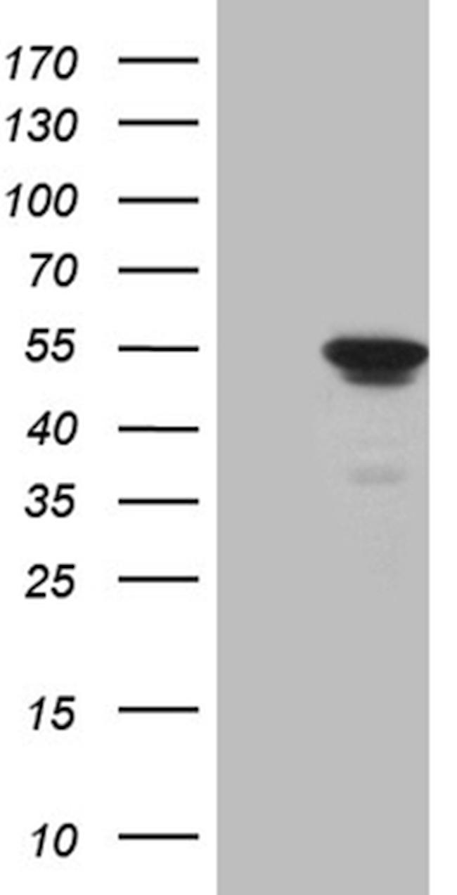 ELP4 Antibody in Western Blot (WB)