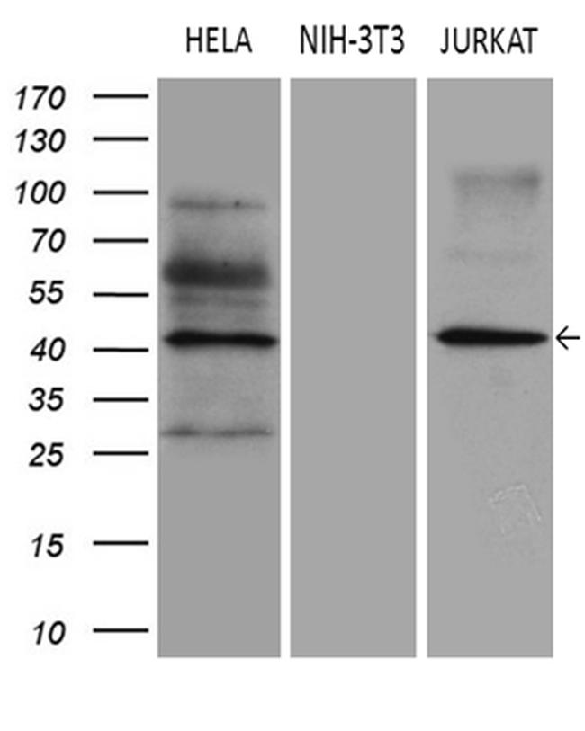 ELP4 Antibody in Western Blot (WB)