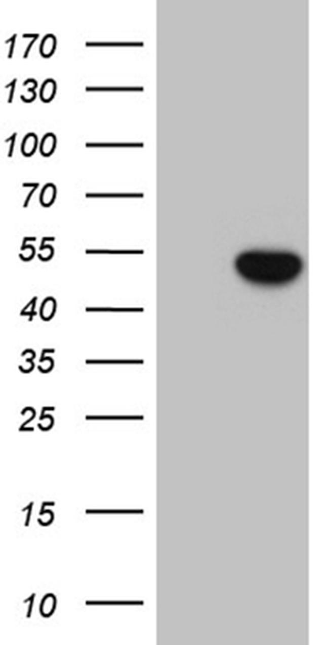 ELP4 Antibody in Western Blot (WB)