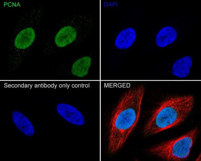 PCNA Antibody in Immunohistochemistry (Paraffin) (IHC (P))