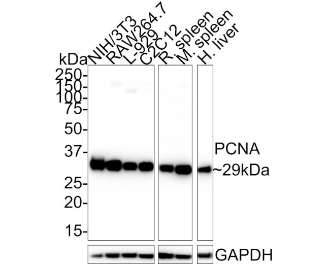 PCNA Antibody in Immunohistochemistry (Paraffin) (IHC (P))