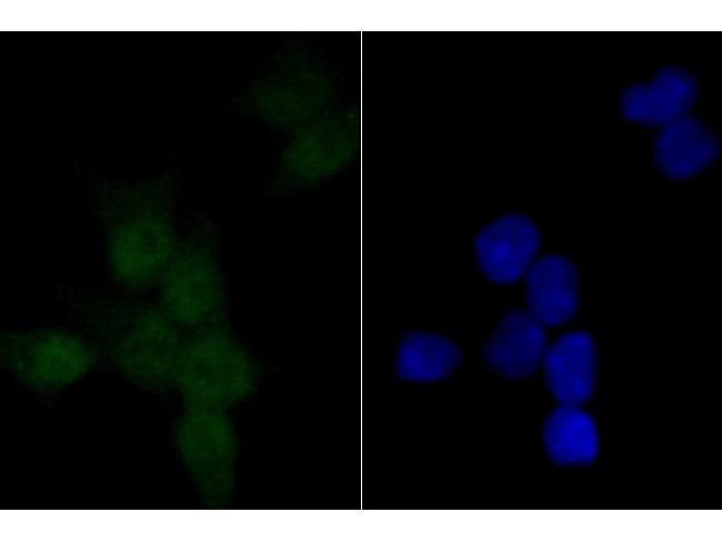 PARP1 Antibody in Immunocytochemistry (ICC/IF)