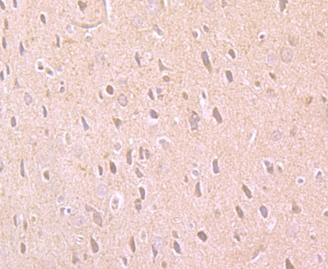 PARP1 Antibody in Immunohistochemistry (Paraffin) (IHC (P))