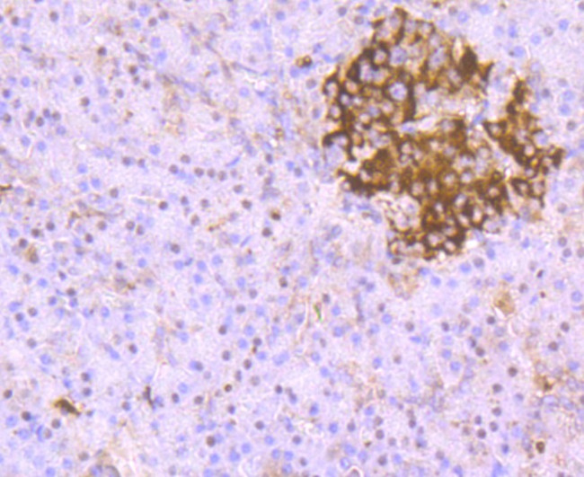 PARP1 Antibody in Immunohistochemistry (Paraffin) (IHC (P))