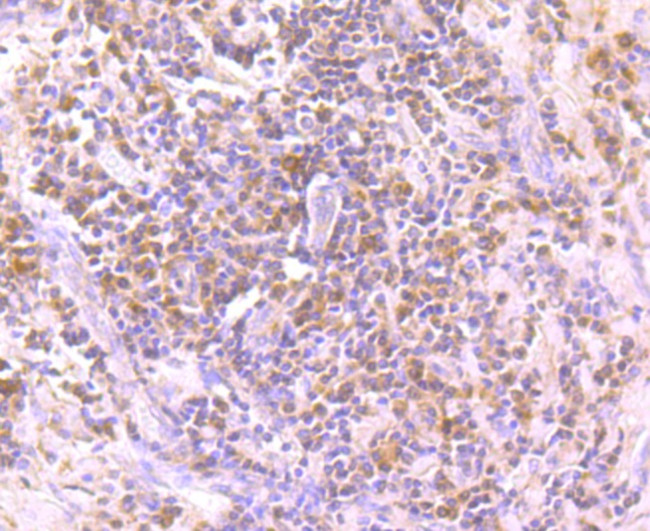 PARP1 Antibody in Immunohistochemistry (Paraffin) (IHC (P))