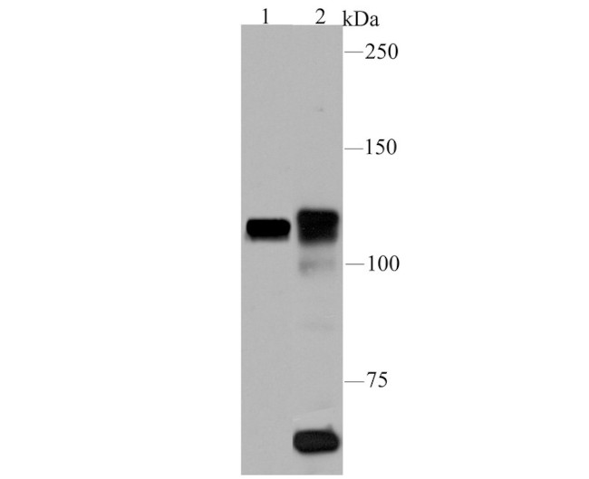 PARP1 Antibody in Western Blot (WB)