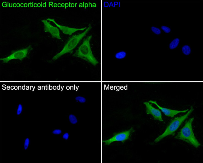 Glucocorticoid Receptor alpha Antibody in Immunocytochemistry (ICC/IF)