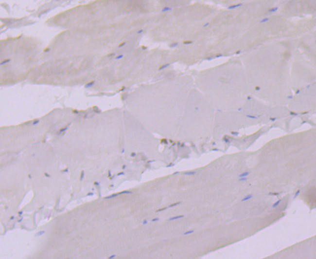 Glucocorticoid Receptor alpha Antibody in Immunohistochemistry (Paraffin) (IHC (P))