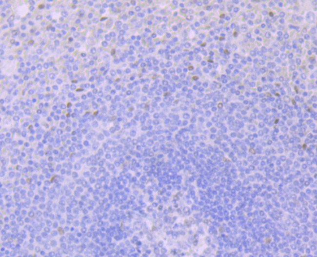 Glucocorticoid Receptor alpha Antibody in Immunohistochemistry (Paraffin) (IHC (P))