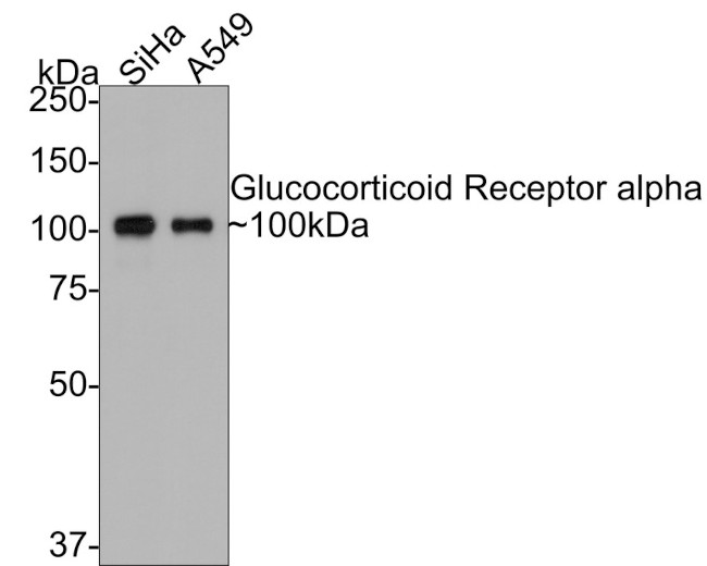 Glucocorticoid Receptor alpha Antibody in Western Blot (WB)