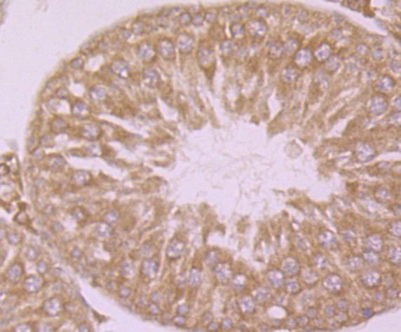 Calpain 1 Antibody in Immunohistochemistry (Paraffin) (IHC (P))