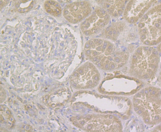 NQO1 Antibody in Immunohistochemistry (Paraffin) (IHC (P))