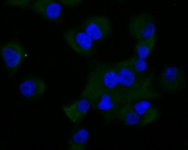 MMP9 Antibody in Immunocytochemistry (ICC/IF)