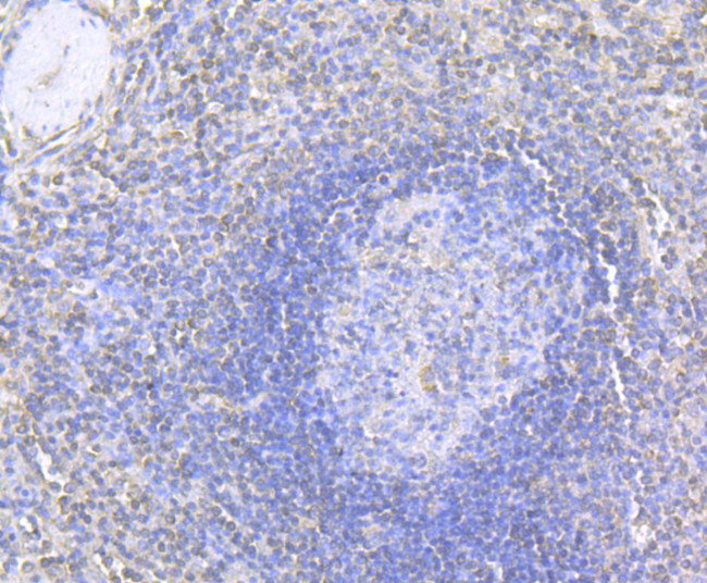 MMP9 Antibody in Immunohistochemistry (Paraffin) (IHC (P))