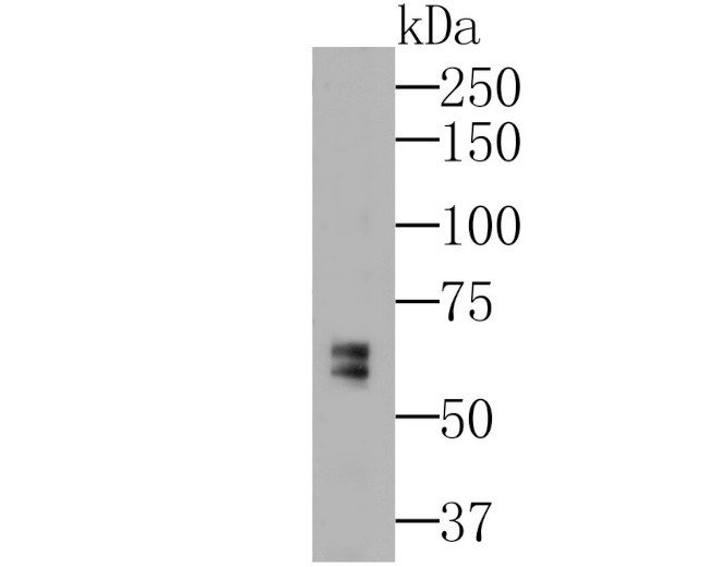 MMP9 Antibody in Western Blot (WB)