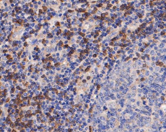 ZAP70 Antibody in Immunohistochemistry (Paraffin) (IHC (P))