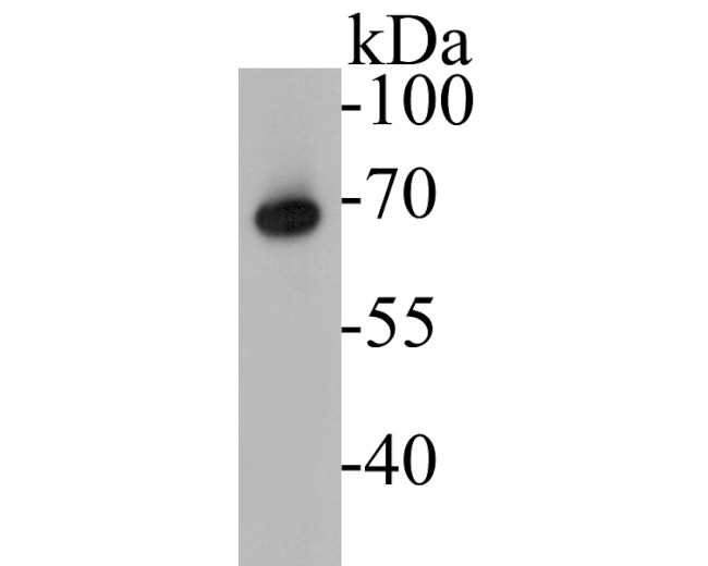 ZAP70 Antibody in Western Blot (WB)