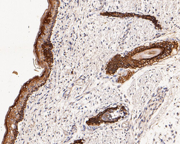 Cytokeratin 17 Antibody in Immunohistochemistry (Paraffin) (IHC (P))