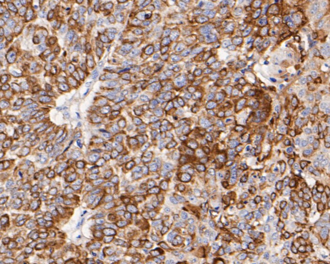 Cytokeratin 17 Antibody in Immunohistochemistry (Paraffin) (IHC (P))