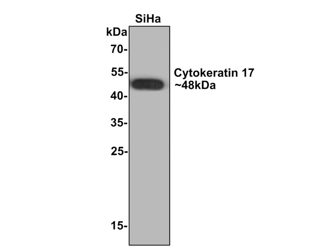 Cytokeratin 17 Antibody in Western Blot (WB)