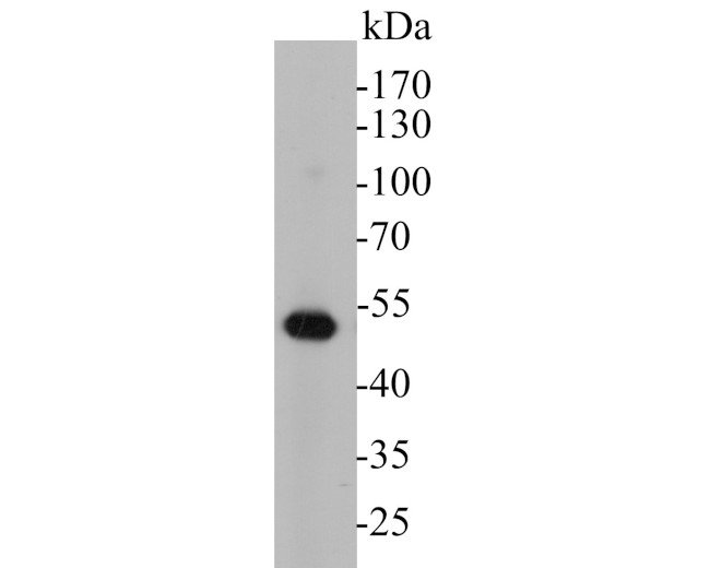 Cytokeratin 17 Antibody in Western Blot (WB)