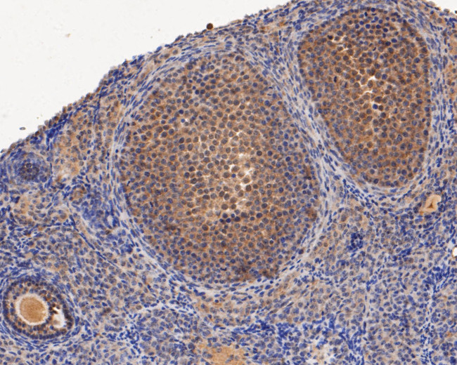 ERK2 Antibody in Immunohistochemistry (Paraffin) (IHC (P))