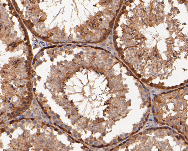 ERK2 Antibody in Immunohistochemistry (Paraffin) (IHC (P))