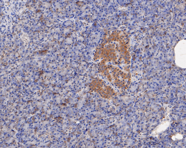 ERK2 Antibody in Immunohistochemistry (Paraffin) (IHC (P))