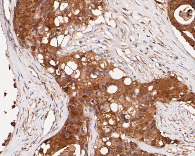 ERK2 Antibody in Immunohistochemistry (Paraffin) (IHC (P))