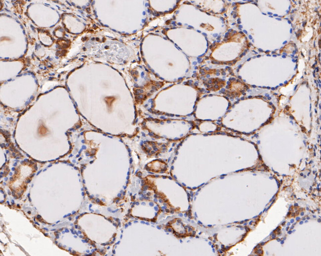 ERK2 Antibody in Immunohistochemistry (Paraffin) (IHC (P))