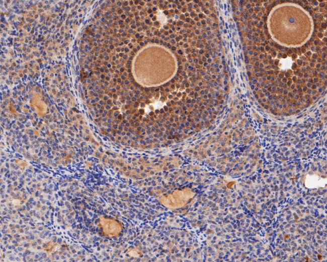 ERK2 Antibody in Immunohistochemistry (Paraffin) (IHC (P))