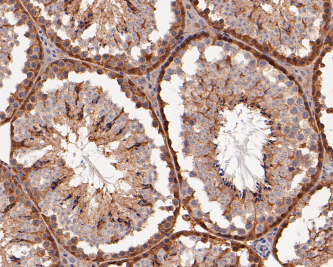 ERK2 Antibody in Immunohistochemistry (Paraffin) (IHC (P))