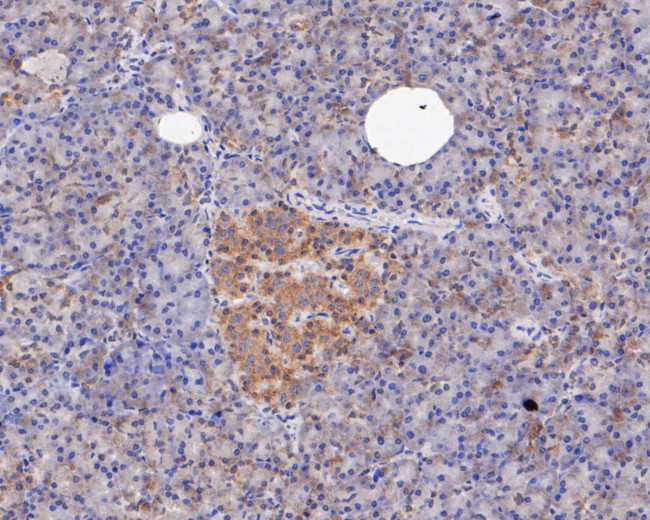 ERK2 Antibody in Immunohistochemistry (Paraffin) (IHC (P))