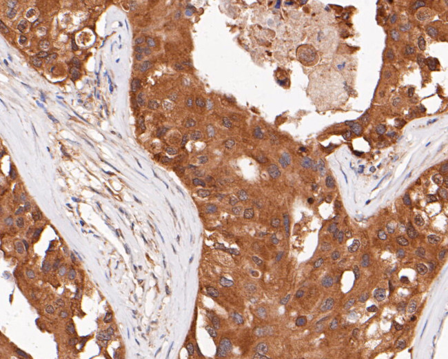 ERK2 Antibody in Immunohistochemistry (Paraffin) (IHC (P))