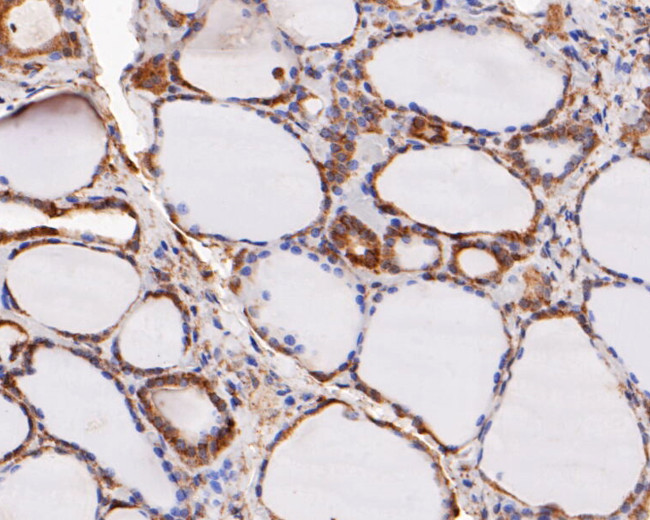 ERK2 Antibody in Immunohistochemistry (Paraffin) (IHC (P))