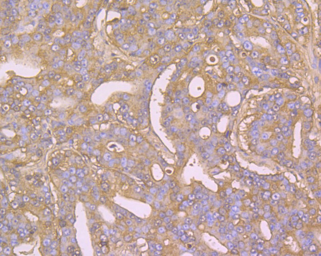 Albumin Antibody in Immunohistochemistry (Paraffin) (IHC (P))