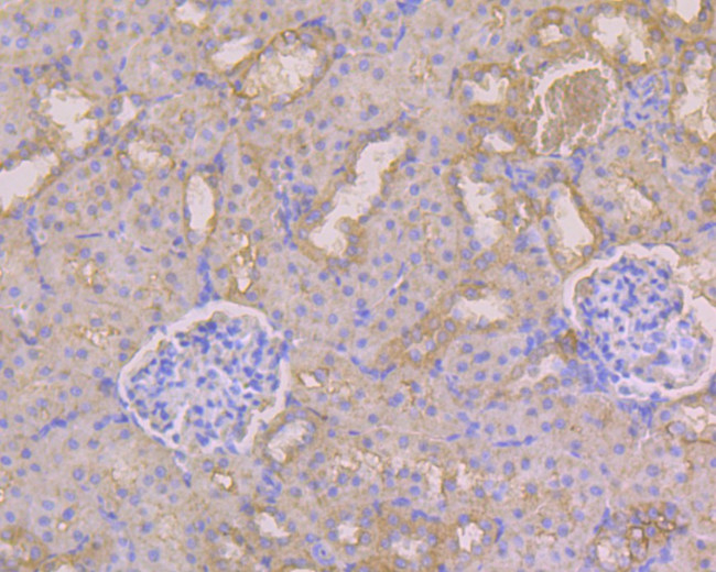 Albumin Antibody in Immunohistochemistry (Paraffin) (IHC (P))