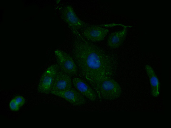 Caveolin-1 Antibody in Immunocytochemistry (ICC/IF)