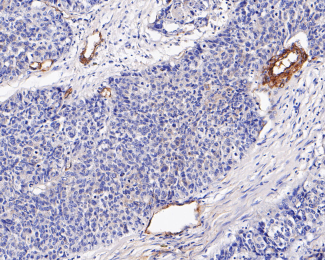 Caveolin-1 Antibody in Immunohistochemistry (Paraffin) (IHC (P))