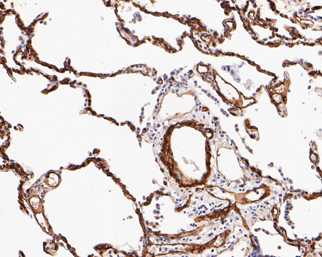 Caveolin-1 Antibody in Immunohistochemistry (Paraffin) (IHC (P))