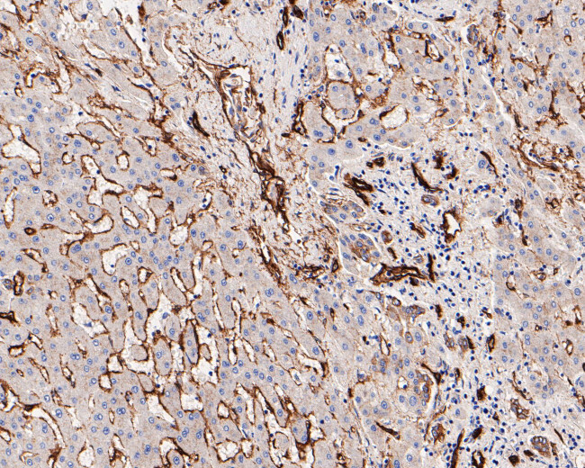 Caveolin-1 Antibody in Immunohistochemistry (Paraffin) (IHC (P))