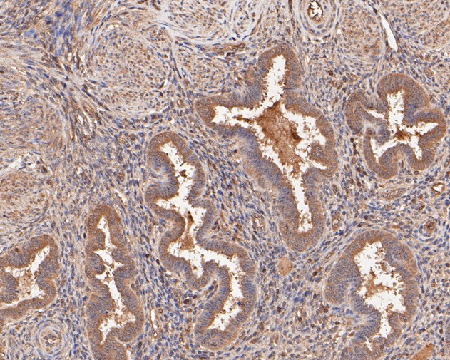 COX2 Antibody in Immunohistochemistry (Paraffin) (IHC (P))