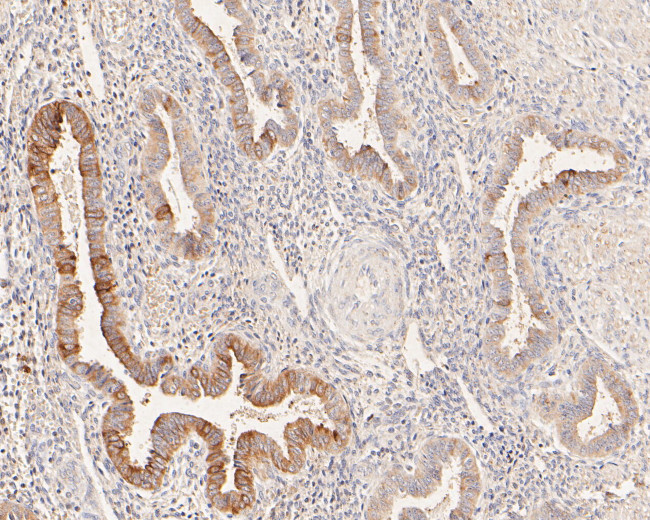 MUC1 Antibody in Immunohistochemistry (Paraffin) (IHC (P))