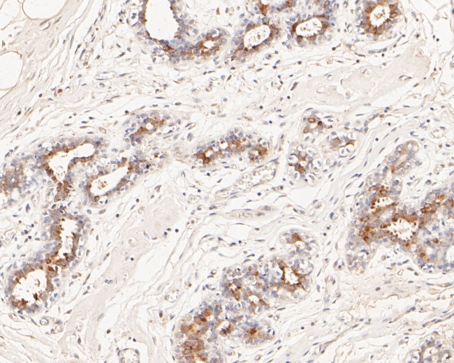 MUC1 Antibody in Immunohistochemistry (Paraffin) (IHC (P))