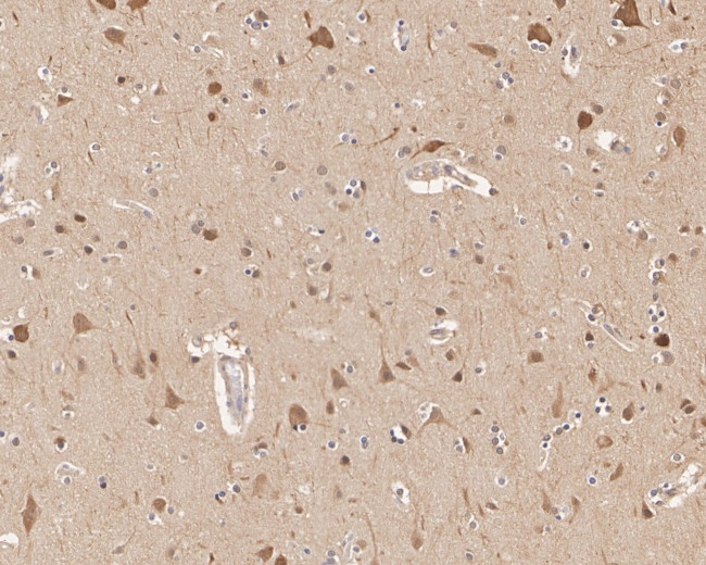 HSP90 Beta Antibody in Immunohistochemistry (Paraffin) (IHC (P))